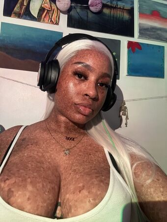 freckledn