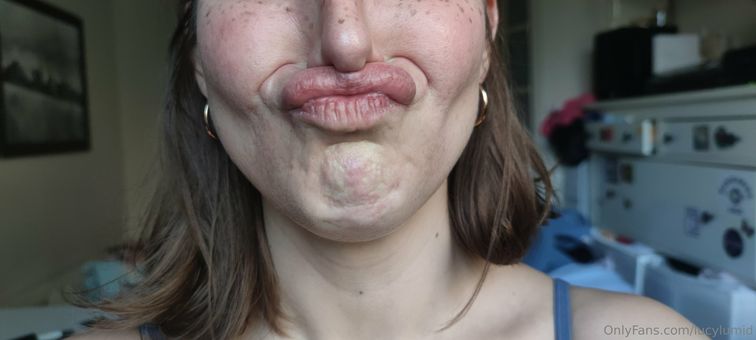 lucylumid