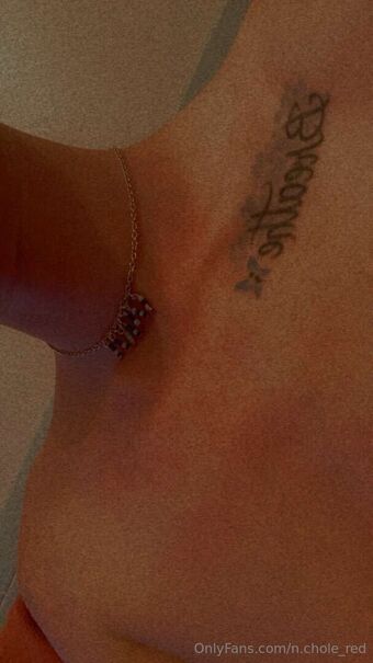 n.chole_red