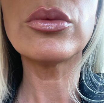 Nipsstrips Nøgen Lækager OnlyFans Foto 4
